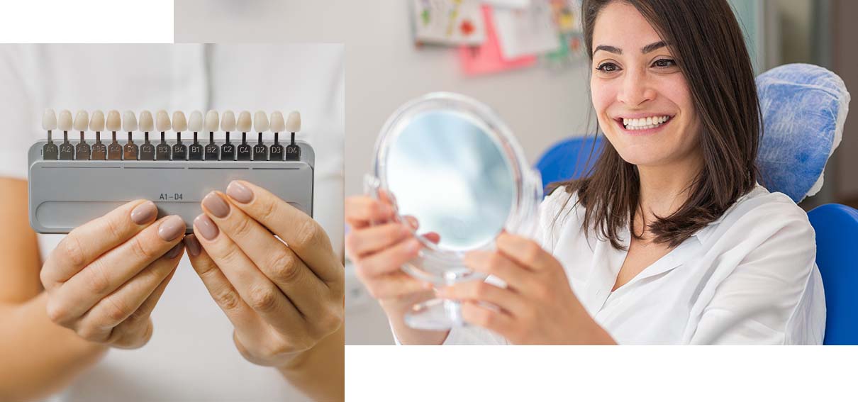 Woman looking in a mirror and smiling. Inset photo of teeth shade guide.