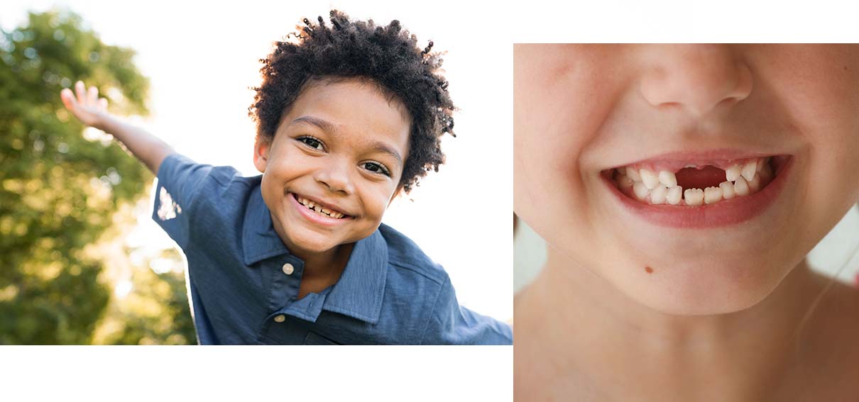 Little boy smiling outside. Inset of smile with missing front teeth.