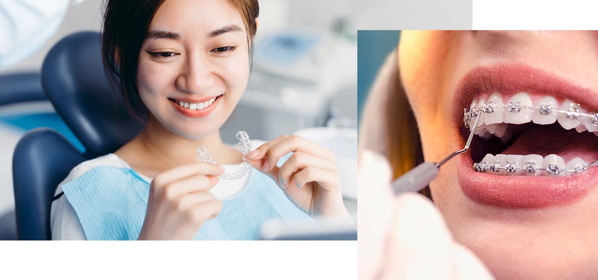 Woman holding a clear aligner. Inset of mouth with metal braces.